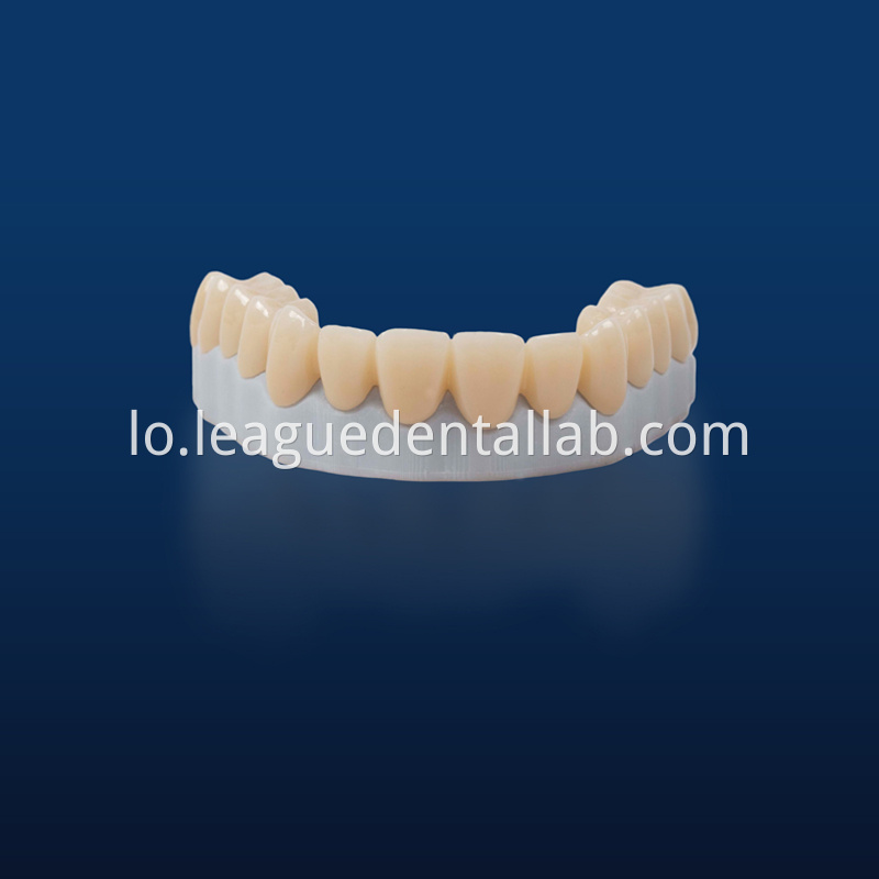 Full Zirconia crown,Full contour zirconia,Solid Zirconia,Zirconia,Monolithic Zirconia